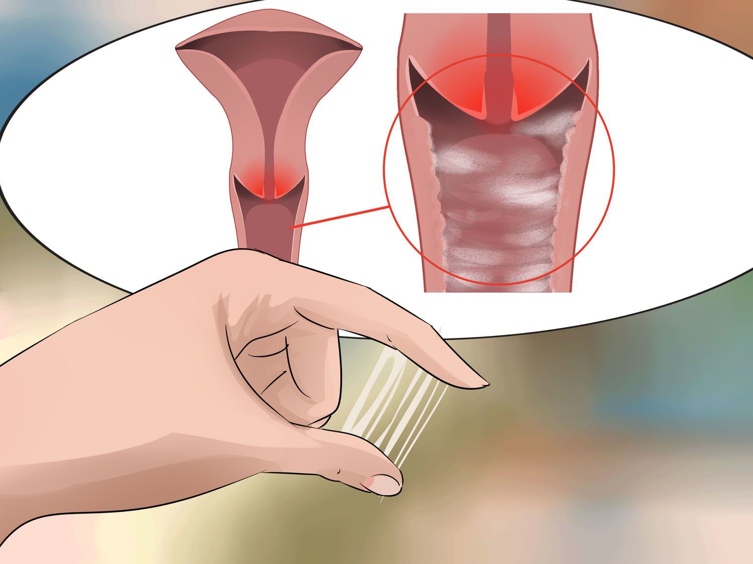 Những căn bệnh viêm sinh dục ở nữ thường gặp