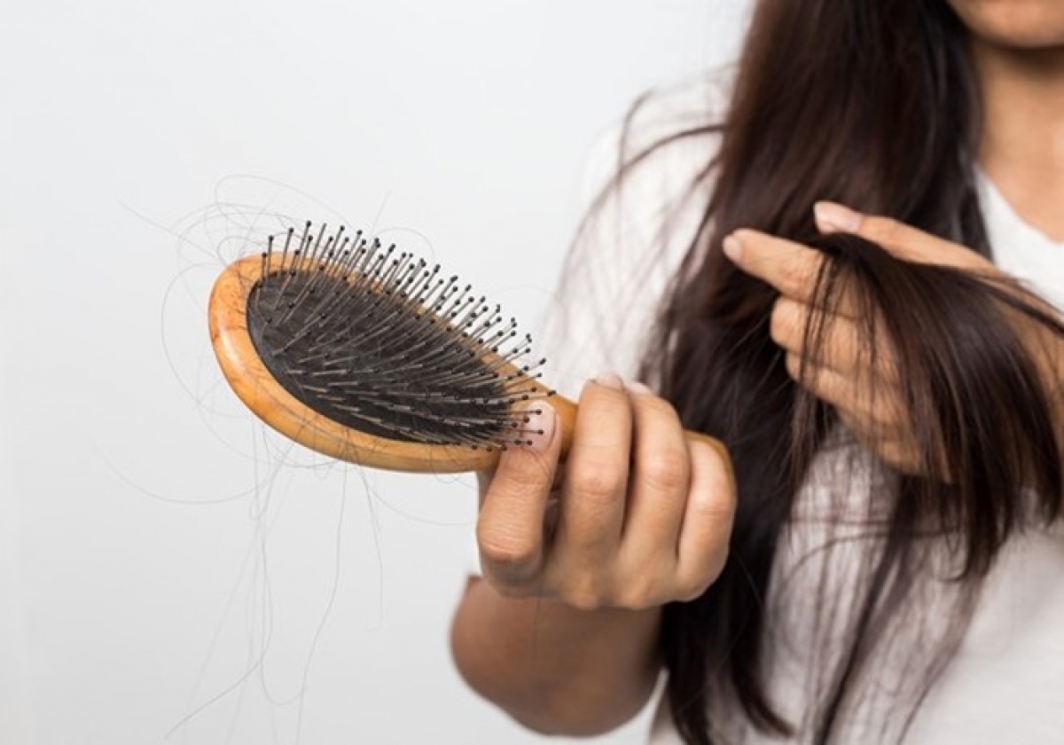 8 bí quyết giảm rụng tóc